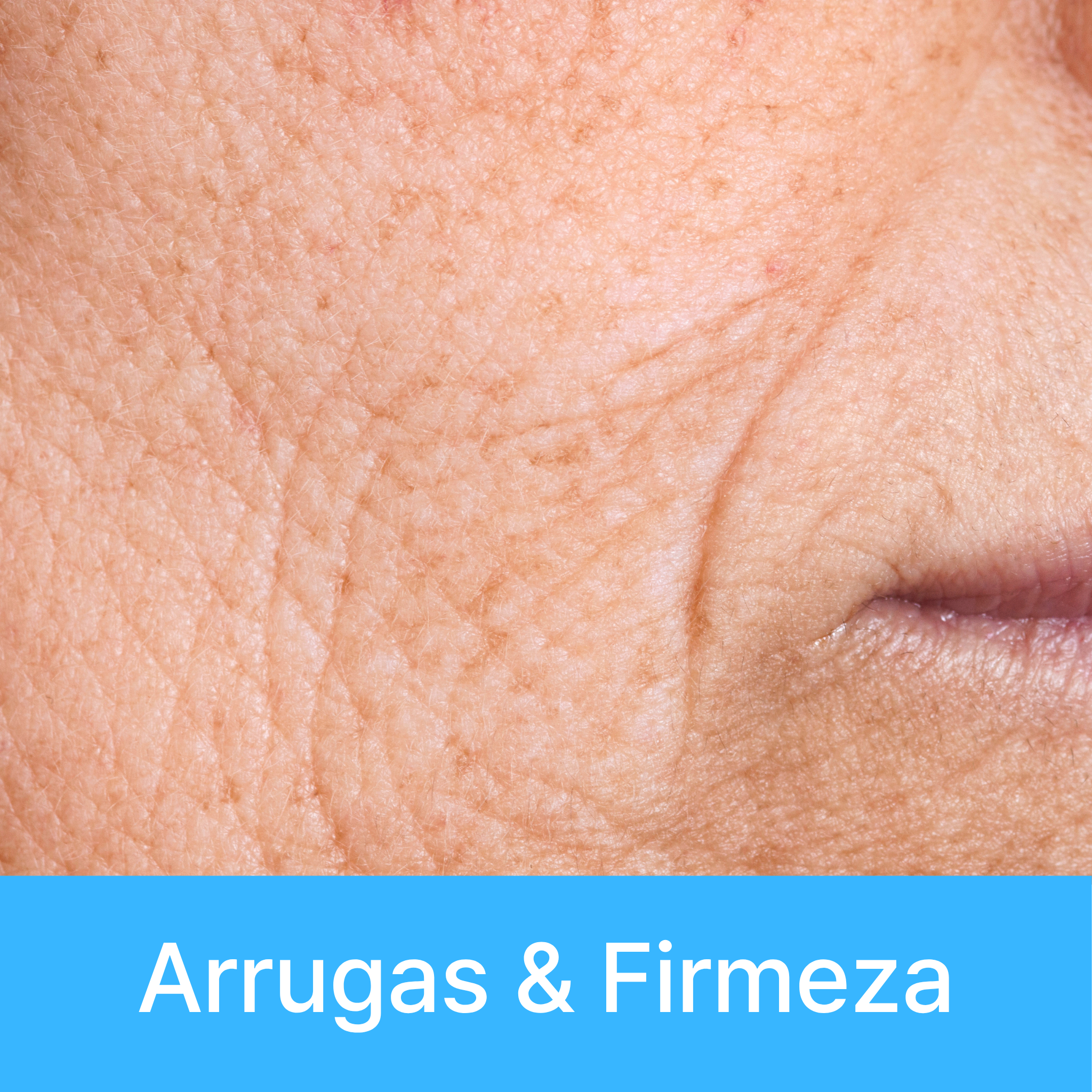 Arrugas & Firmeza