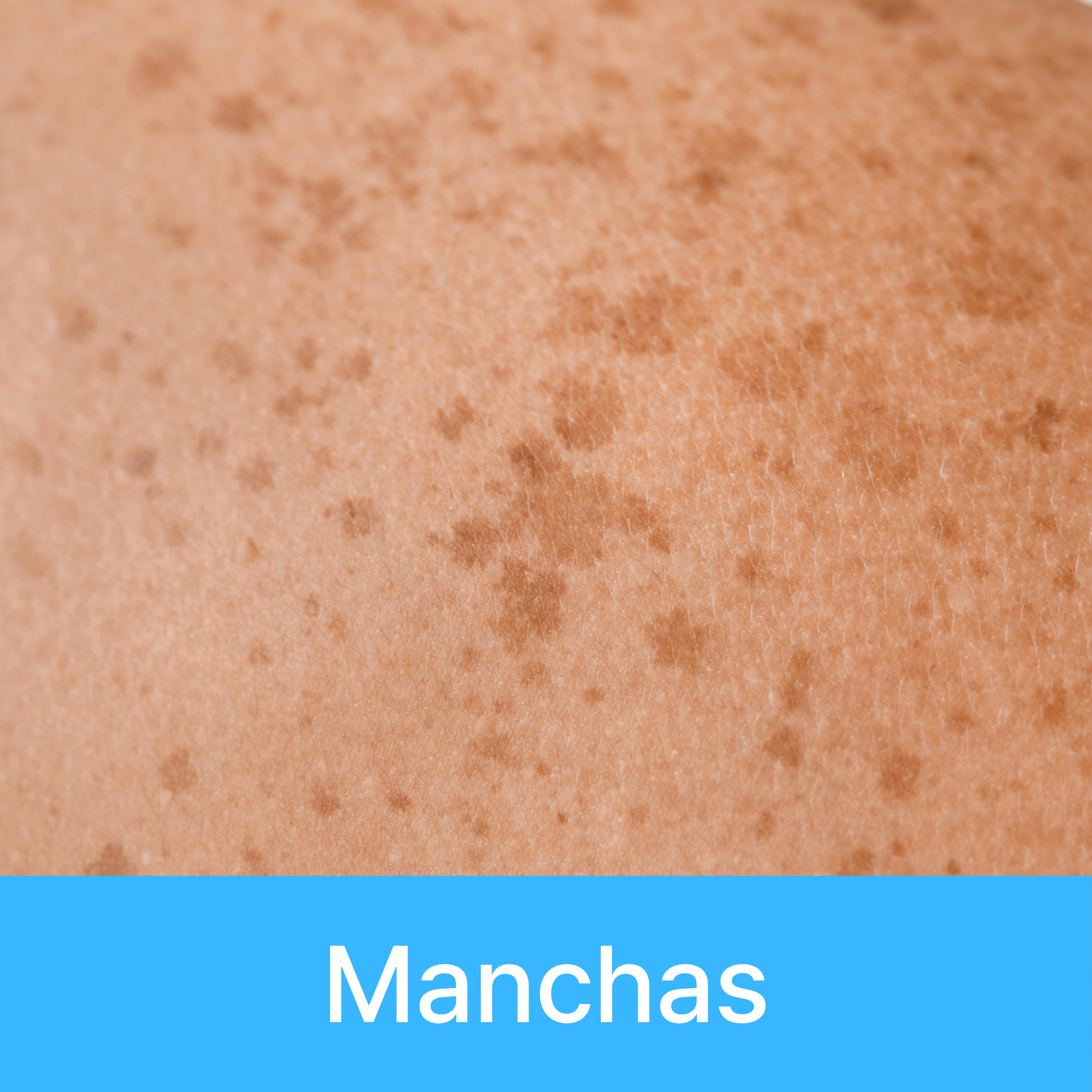 Manchas