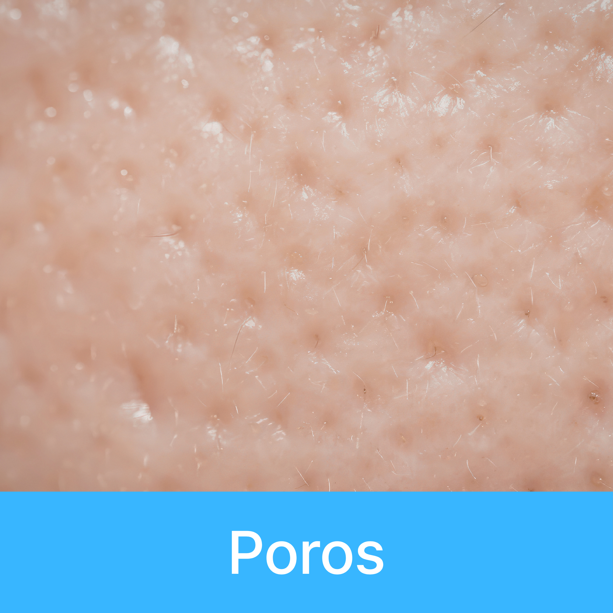 Poros